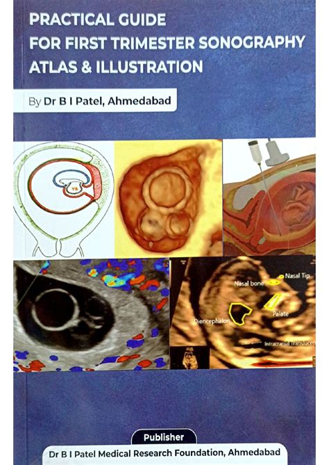 Practical guide First trimester sonography atlas & illustration