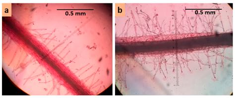 Salinity Stress Alters Root Morphology and Root Hair Traits in Brassica ...