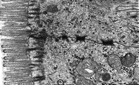 Rezultat imagine pentru Intercellular Junctions