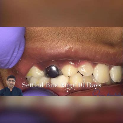 Short videos: The OD Clinical Skills Program-One Dental is the Biggest ...