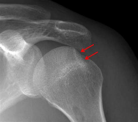 Case #3 | CaseStacks.com