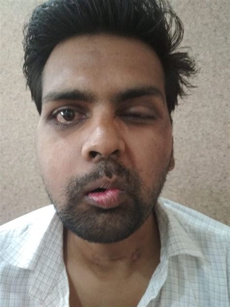 Rajani Sports and Spine Rehabilitation | +918006474245 | Sports and ...