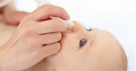 Why Is My Baby Getting Yellow Eye Boogers at Lola Goll blog