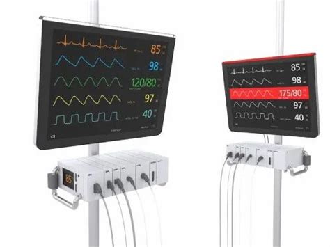 Image result for Portable Monitoring System Examples