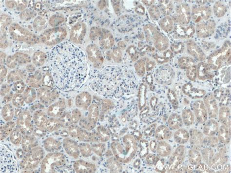 MLPH antibody (66092-1-PBS) | Proteintech