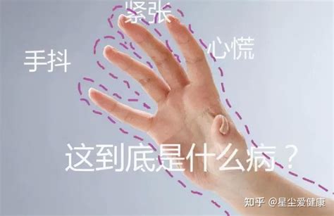 手发抖是什么病的先兆（经常手抖，是这3种疾病的征兆，检查一下比较好） | 说明书网
