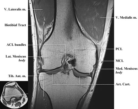 Healthy Knee Mri