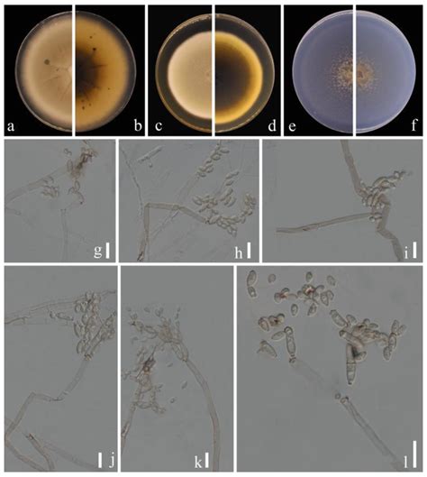 Cladosporium Species Associated with Fruit Trees in Guizhou Province, China