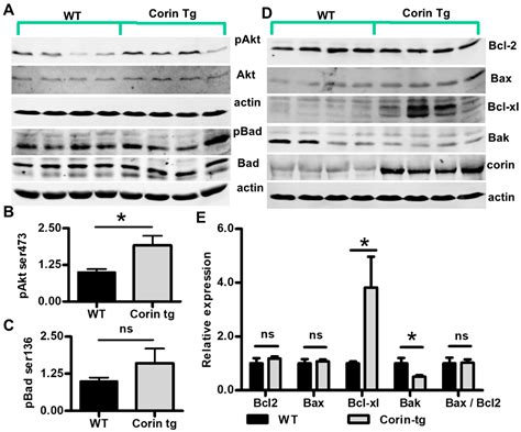 Corin Overexpression Reduces Myocardial Infarct Size and Modulates ...
