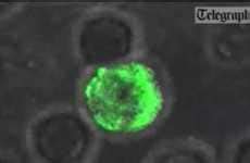 Medical Science Breakthroughs: The Autonomous Artificial Heart