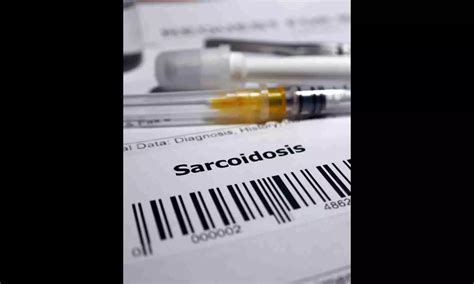 Sarcoidosis: Symptoms, Causes & Treatment And Side Effects