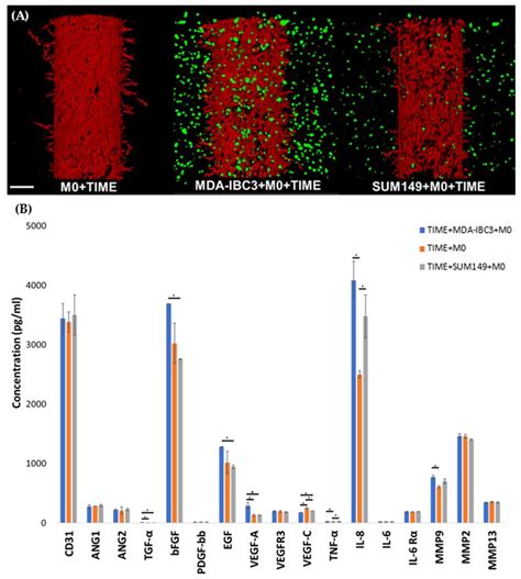 Influence of Macrophages on Vascular Invasion of Inflammatory Breast ...