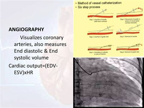 Image result for Cardiac Output Measurement