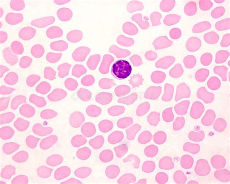 Image result for Lymphocytes Microscopic View
