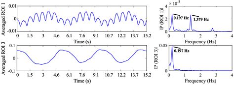 System Description and First Application of an FPGA-Based Simultaneous ...