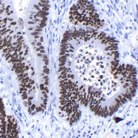 SATB2 - PRM111 | PathnSitu Biotechnologies