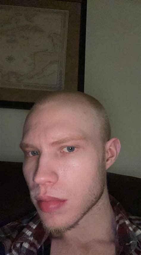 Do I have a weird head shape? : r/bald