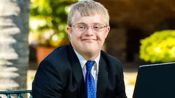 Immunodeficiencies : Hyper Ige Syndrome (job's Syndrome) : Hyper Ige ...