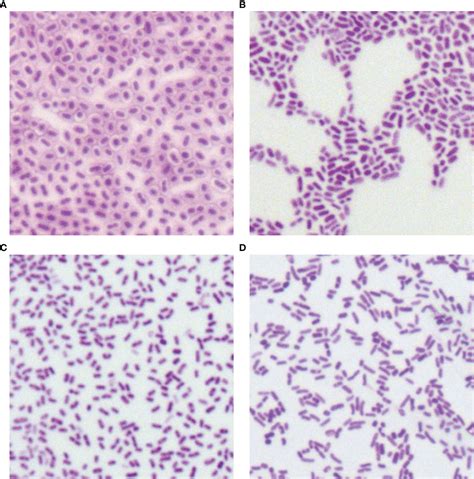 Klebsiella Pneumoniae Gram Stain