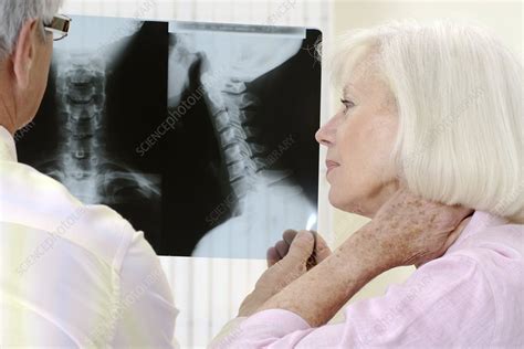 Image result for Neck X-Ray