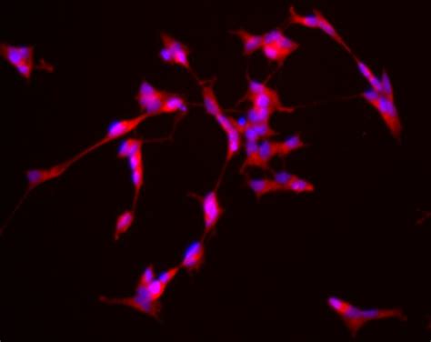 SHSY-5Y Tet-On Inducible Alpha-Synuclein Neuroblastoma Cell Line | SCC291