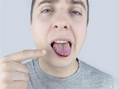 10 Spiritual Meanings of Black Spots on the Tongue - What Spiritual