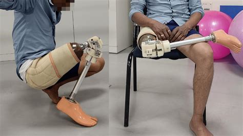 IIT Guwahati creates affordable prosthetic leg for Indians that allows ...