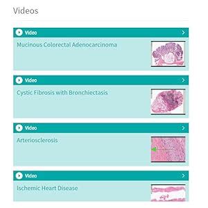 Buy Robbins & Cotran Pathologic Basis of Disease (Robbins Pathology ...