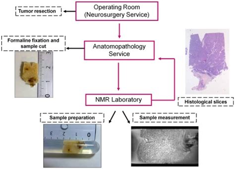 Image result for Tissue Sample during Surgery