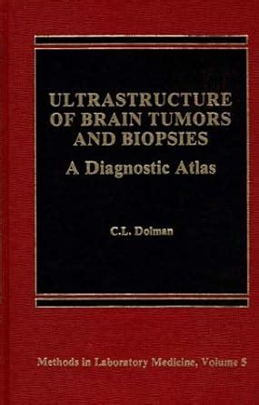 Buy Ultrastructure of Brain Tumors and Biopsies: A Diagnostic Atlas ...