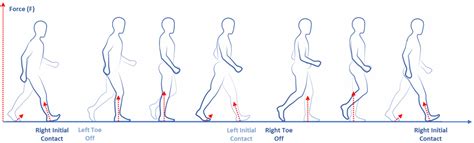 Gait Analysis in Parkinson’s Disease: An Overview of the Most Accurate ...