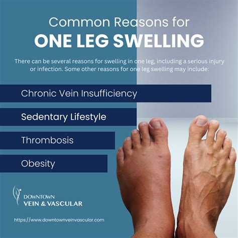 What Are the Main Causes of Swelling in a Single Leg?