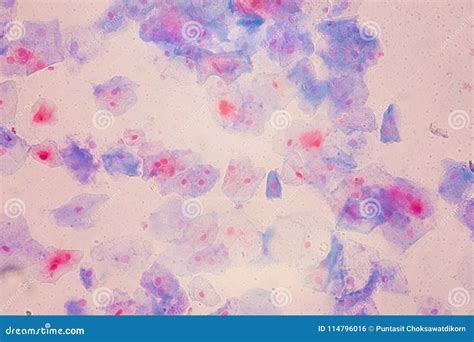 Squamous Epithelial Cells Under Microscope View for Education Hi Stock ...