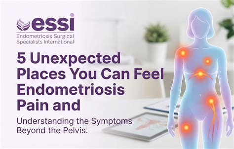 5 Unexpected Places You Can Feel Endometriosis Pain - ESSI