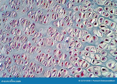 Human Hyaline Cartilage Bone Under Light Microscope View, 41% OFF