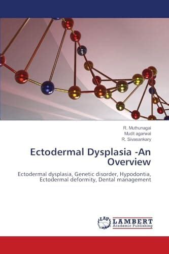 Buy Ectodermal Dysplasia -An Overview Book Online at Low Prices in ...