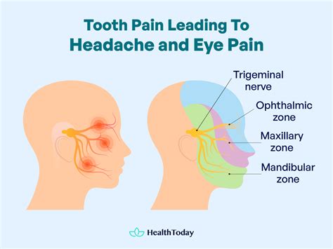 Toothache Causing Headache and Eye Pain | Hidden Links