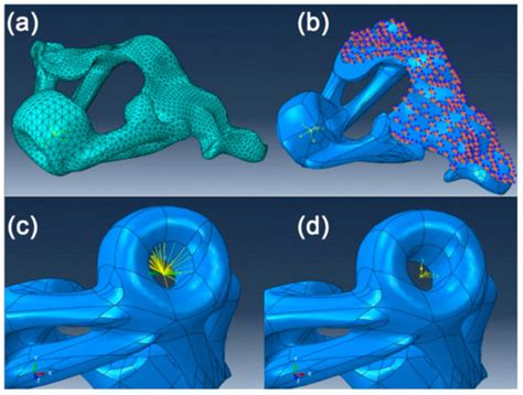 FEM Analysis of Individualized Polymeric 3D Printed Guide for ...