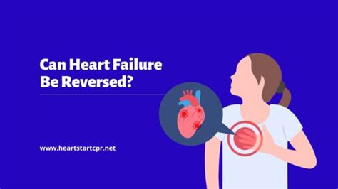 Resuscitation Triangle Roles in ACLS High-Performance Team