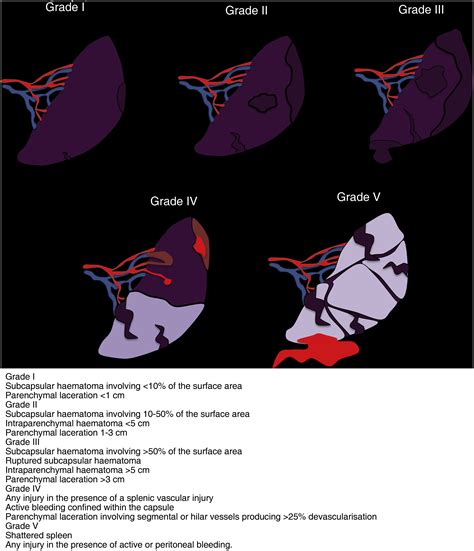 Abdominal trauma | Radiología (English Edition)