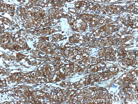 IGF1R/CD221 antibody (20254-1-AP) | Proteintech