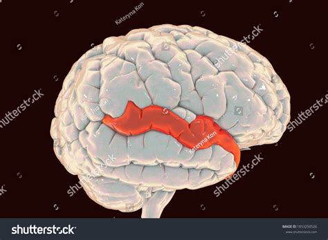 Transverse Temporal Gyrus Anatomy