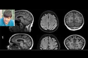 Delhi scientist develops software for 3D, interactive viewing of CT/MRI ...