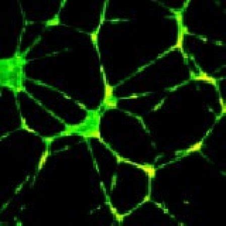 Angiogenesis Research Process in Cancer | Research, Resources, and ...