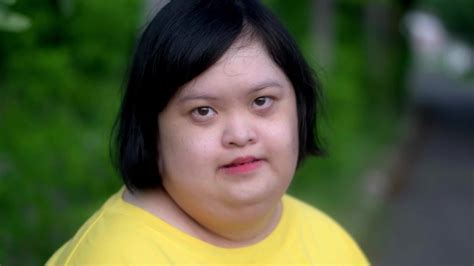 Asian young female Down syndrome looking at you with smile. 26637866 ...