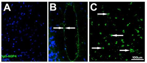 Sera from Patients with NMOSD Reduce the Differentiation Capacity of ...