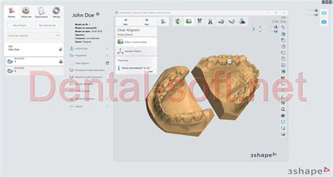 Image result for 3Shape Software