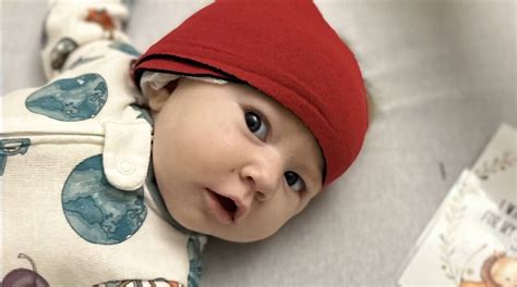 Baby among youngest to receive cochlear implant after meningitis battle