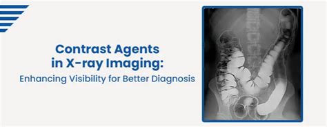 Contrast Agents in X-ray Imaging: Enhanced Diagnosis