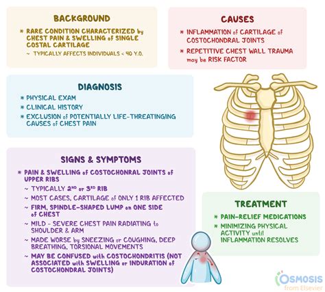 Costochondritis: Symptoms, Causes, Diagnosis And Treatments – JQMCLV